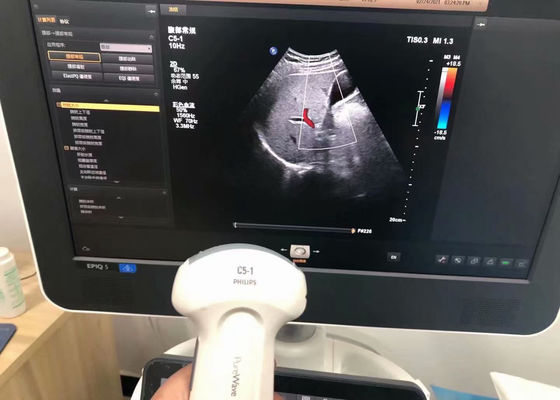 Philip C5-1 Abdominal Medizinische Ultraschallprobe für EPIQ 5 Gerät