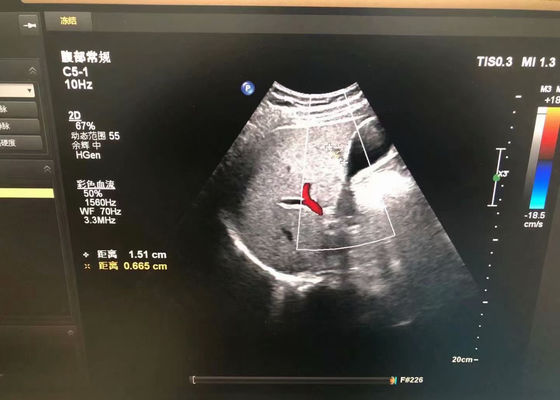 Philip C5-1 Abdominal Medizinische Ultraschallprobe für EPIQ 5 Gerät