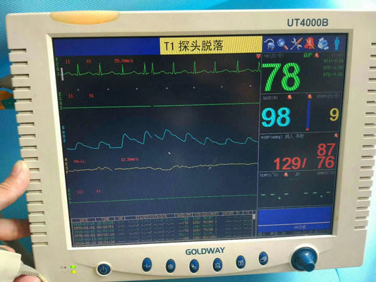 Goldway UT4000B Reparatur von Patientenmonitoren